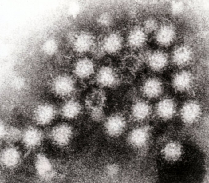 ノロウイルス対策